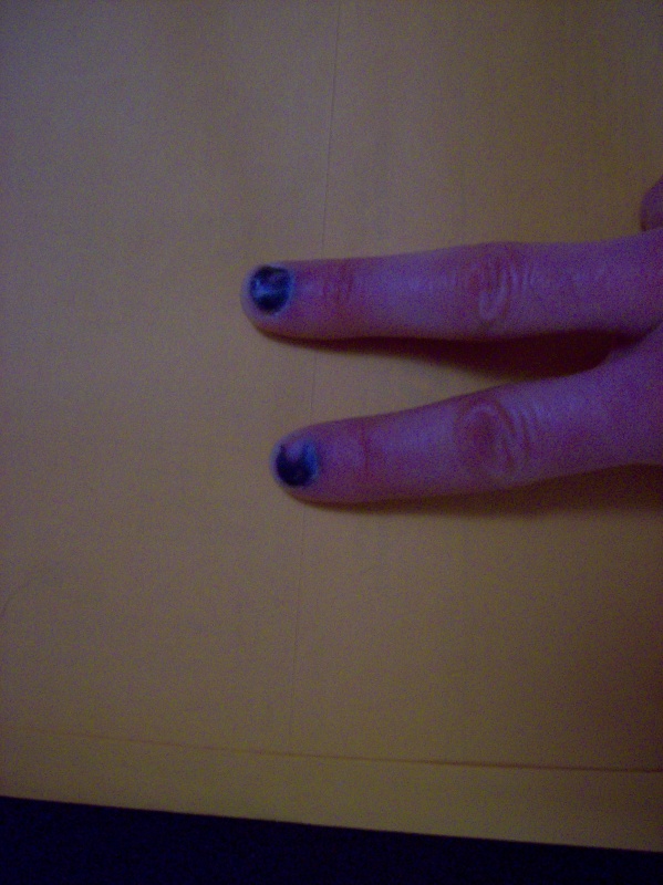 Not trying to go Goth...I tried to stop a heavy metal door from slamming in strong wind.  Bad idea...